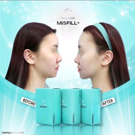 Мисфил Плюс Дайамонд