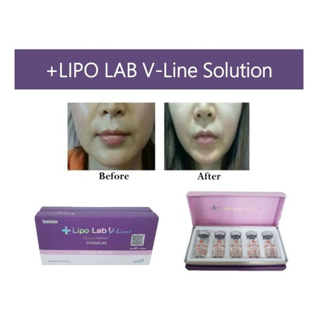 Lipo Lab V-line – это липолитик премиум-класса