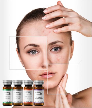 B- TOX Soyma Seti Matrigen