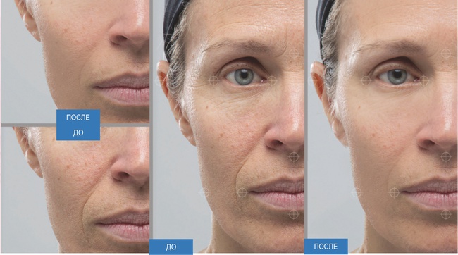 Toptan Peptidli Kozmetik