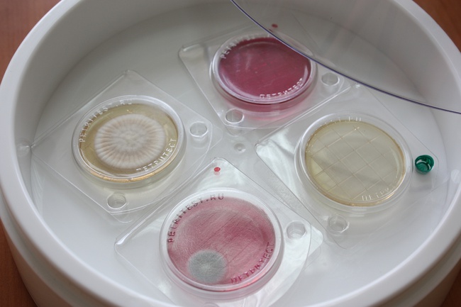 BGKP&#39;nin petritest (ped)