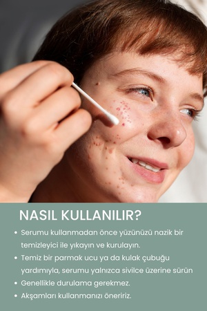 Akne Karşıtı Kurutucu Lokal Jel 30 ml