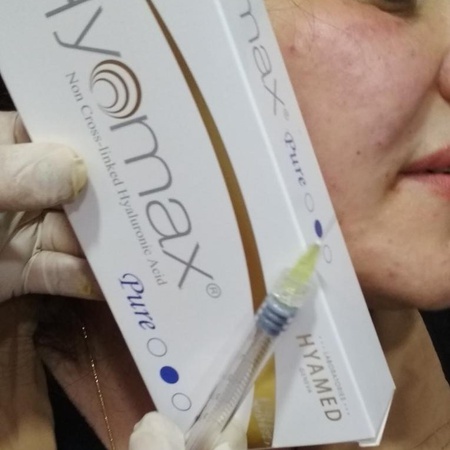 Филлер и ботокс