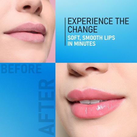 Yuthika Naturals Soft Touch Lip Balm Clear, Hydrates & Moisturizes 5 Gram (Pack of 20) with Jar