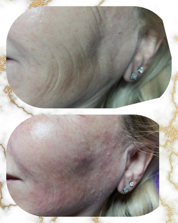 Скинбустер ILLUMA Crystal rose