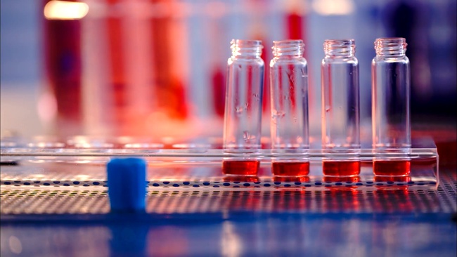 Özelleştirilmiş çözümler