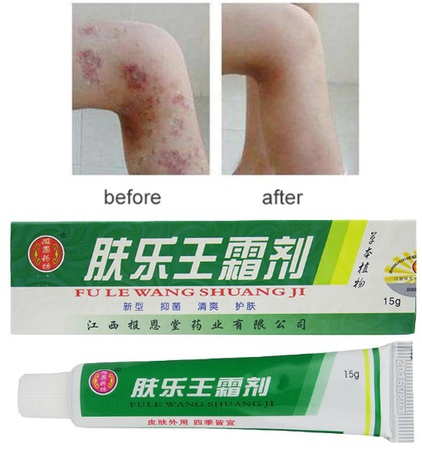 Чудо Мазь от псориаза